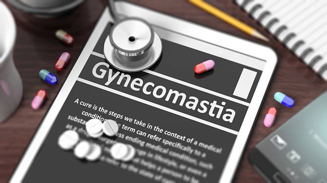 Gynecomastia